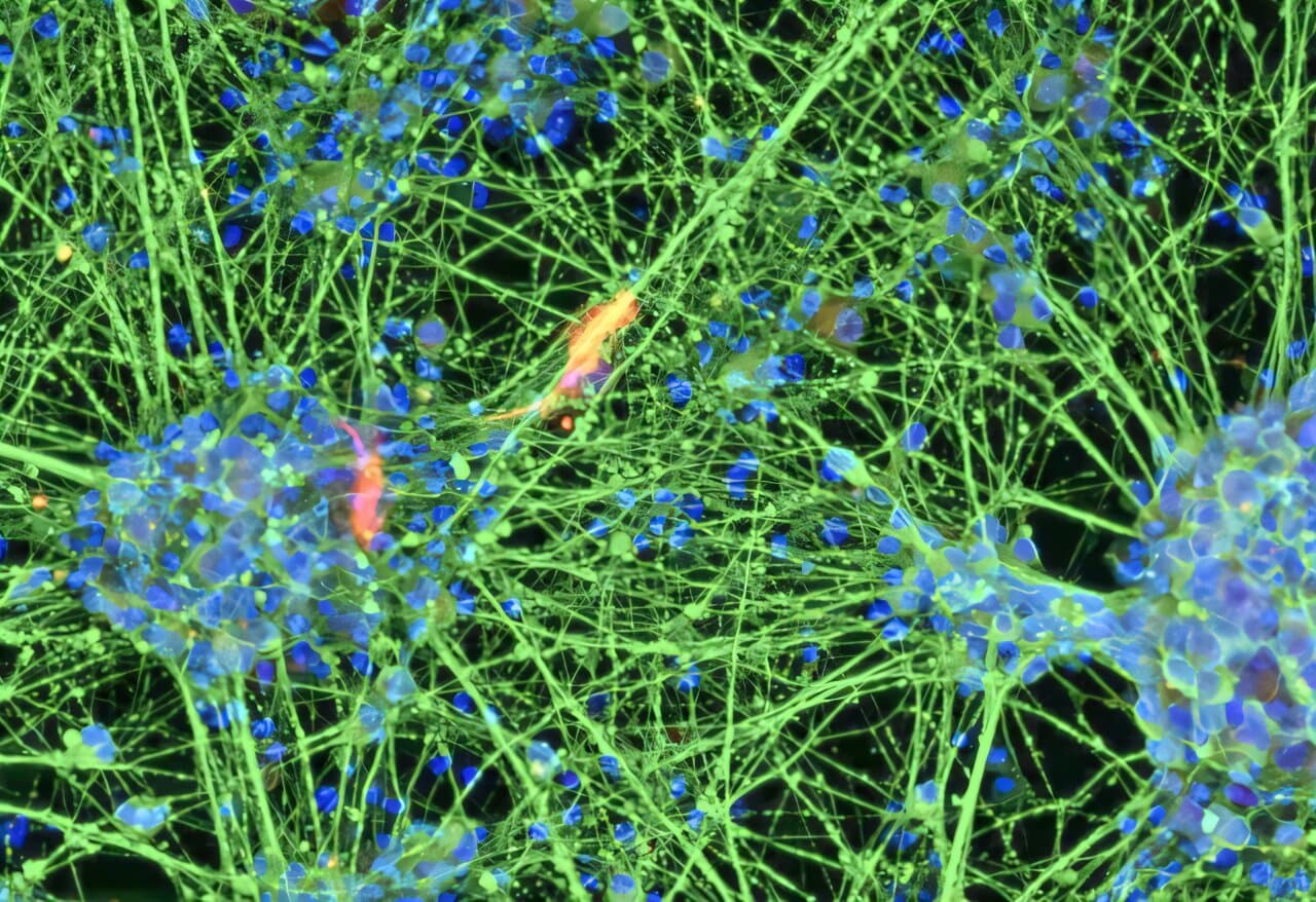 Blood cells from 80-year-old donor become stem cells with molecular age under 20
